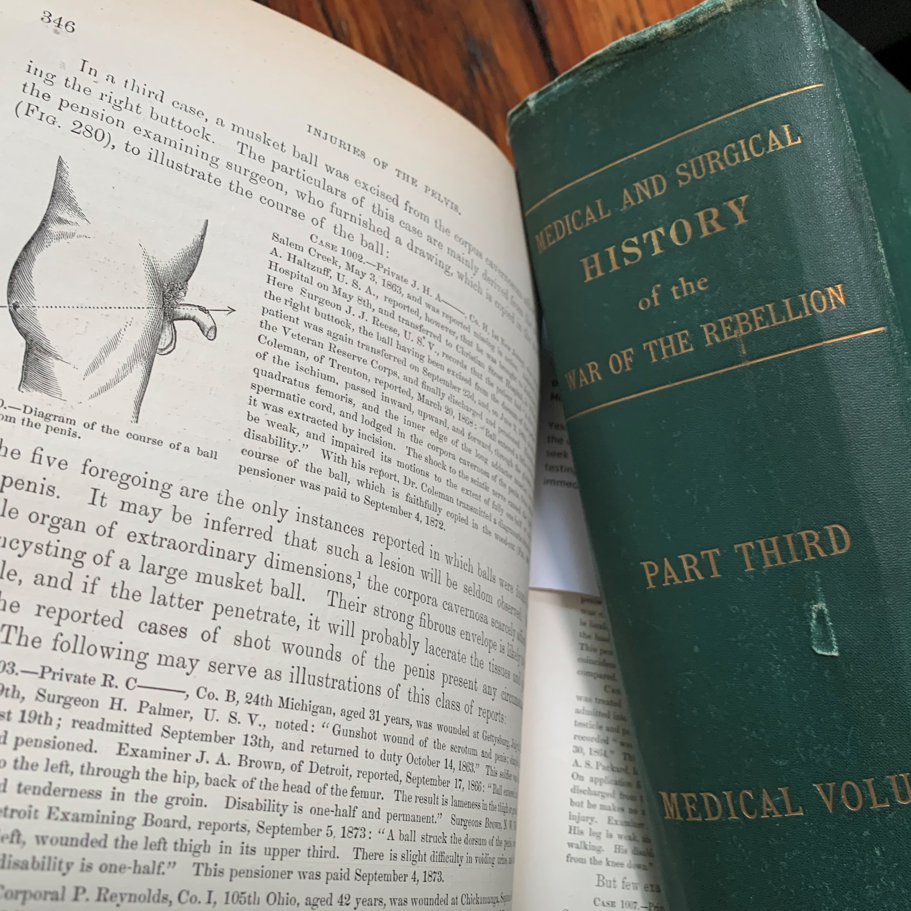 Medical and Surgical History of the War of the Rebellion