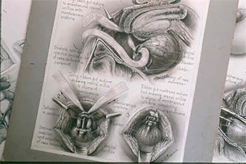 William P. Didusch Medical Illustrations